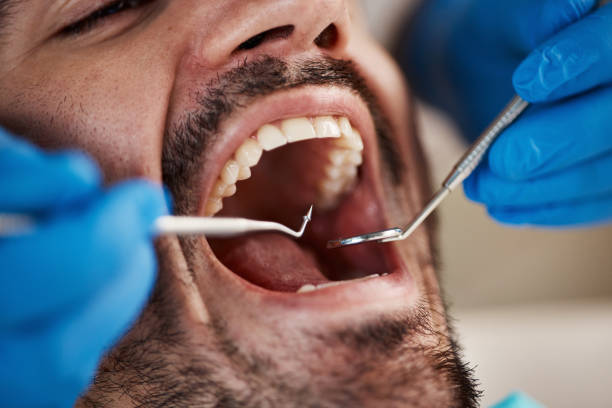 Oral Surgery in Rutherford, NJ